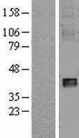 NDUFA10 Protein - Western validation with an anti-DDK antibody * L: Control HEK293 lysate R: Over-expression lysate
