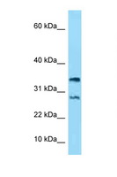 NDUFA11 / B14.7 Antibody - NDUFA11 antibody Western blot of ACHN Cell lysate. Antibody concentration 1 ug/ml.  This image was taken for the unconjugated form of this product. Other forms have not been tested.