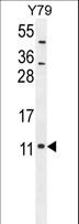 NDUFA11 / B14.7 Antibody - NDUAB Antibody western blot of Y79 cell line lysates (35 ug/lane). The NDUAB antibody detected the NDUAB protein (arrow).