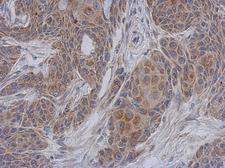 NDUFA12 / B17.2 Antibody - IHC of paraffin-embedded Cal27 xenograft using NDUFA12 antibody at 1:500 dilution.