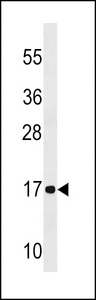 NDUFA12 / B17.2 Antibody - NDUFA12 Antibody western blot of A2058 cell line lysates (35 ug/lane). The NDUFA12 antibody detected the NDUFA12 protein (arrow).