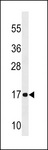 NDUFA12 / B17.2 Antibody - NDUFA12 Antibody western blot of A2058 cell line lysates (35 ug/lane). The NDUFA12 antibody detected the NDUFA12 protein (arrow).