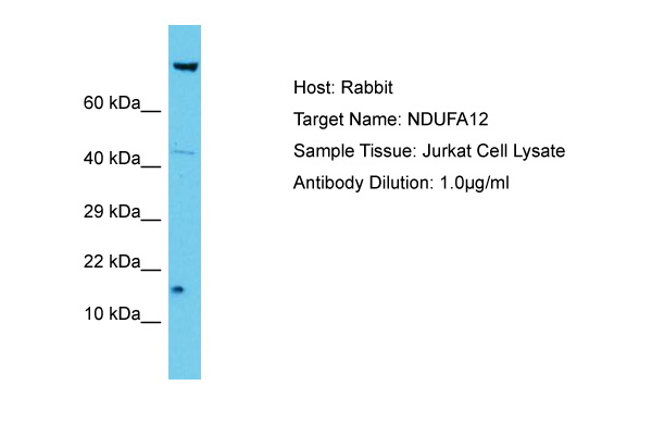 NDUFA12 / B17.2 Antibody -  This image was taken for the unconjugated form of this product. Other forms have not been tested.