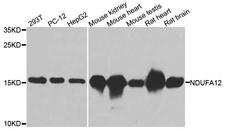 NDUFA12 / B17.2 Antibody - Western blot analysis of extracts of various cell lines.