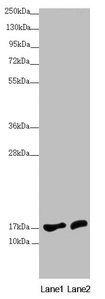 NDUFA12 / B17.2 Antibody - Western blot All lanes: NDUFA12 antibody at 3.71µg/ml Lane 1: HepG2 whole cell lysate Lane 2: 293T whole cell lysate Secondary Goat polyclonal to rabbit IgG at 1/10000 dilution Predicted band size: 18, 8 kDa Observed band size: 18 kDa