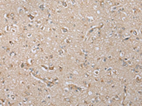 NDUFA12 / B17.2 Antibody - Immunohistochemistry of paraffin-embedded Human brain tissue  using NDUFA12 Polyclonal Antibody at dilution of 1:30(×200)