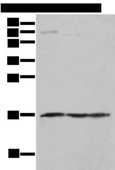 NDUFA12 / B17.2 Antibody - Western blot analysis of Human fetal muscle tissue PC-3 and Jurkat cell  using NDUFA12 Polyclonal Antibody at dilution of 1:300