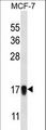 NDUFA13 / GRIM19 Antibody - NDUFA13 Antibody western blot of MCF-7 cell line lysates (35 ug/lane). The NDUFA13 antibody detected the NDUFA13 protein (arrow).