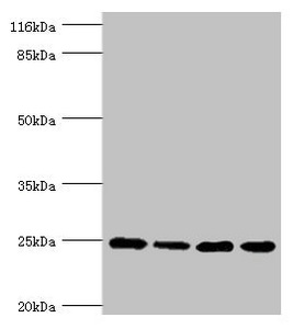 NDUFA13 / GRIM19 Antibody - Western blot All Lanes:NDUFA13 antibody at 3.97ug/ml Lane 1:293T whole cell lysate Lane 2:Hela whole cell lysate Lane 3:Jurkat whole cell lysate Lane 4:MCF-7 whole cell lysate Secondary Goat polyclonal to rabbit at 1/10000 dilution Predicted band size: 17,25 kDa Observed band size: 25 kDa