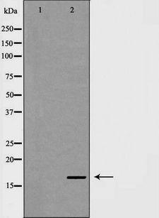 NDUFA13 / GRIM19 Antibody - Western blot analysis of mouse heart lysate using NDUFA13 antibody. The lane on the left is treated with the antigen-specific peptide.