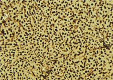 NDUFA13 / GRIM19 Antibody - 1:100 staining mouse liver tissue by IHC-P. The sample was formaldehyde fixed and a heat mediated antigen retrieval step in citrate buffer was performed. The sample was then blocked and incubated with the antibody for 1.5 hours at 22°C. An HRP conjugated goat anti-rabbit antibody was used as the secondary.