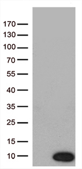 NDUFA2 Antibody - HEK293T cells were transfected with the pCMV6-ENTRY control. (Left lane) or pCMV6-ENTRY NDUFA2. (Right lane) cDNA for 48 hrs and lysed. Equivalent amounts of cell lysates. (5 ug per lane) were separated by SDS-PAGE and immunoblotted with anti-NDUFA2. (1:200)
