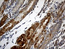 NDUFA2 Antibody - Immunohistochemical staining of paraffin-embedded Human gastric tissue within the normal limits using anti-NDUFA2 mouse monoclonal antibody. (Heat-induced epitope retrieval by 1mM EDTA in 10mM Tris buffer. (pH8.5) at 120°C for 3 min. (1:150)