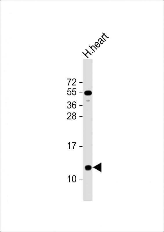 NDUFA2 Antibody - Anti-NDUFA2 Antibody (C-Term) at 1:2000 dilution + Human heart lysate Lysates/proteins at 20 µg per lane. Secondary Goat Anti-Rabbit IgG, (H+L), Peroxidase conjugated at 1/10000 dilution. Predicted band size: 11 kDa Blocking/Dilution buffer: 5% NFDM/TBST.