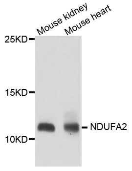 NDUFA2 Antibody - Western blot analysis of extract of various cells.
