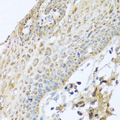 NDUFA2 Antibody - Immunohistochemistry of paraffin-embedded human esophagus.