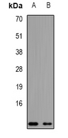 NDUFA2 Antibody - Western blot analysis of NDUFA2 expression in mouse kidney (A); mouse heart (B) whole cell lysates.