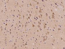 NDUFA2 Antibody - Immunochemical staining of human NDUFA2 in human brain with rabbit polyclonal antibody at 1:100 dilution, formalin-fixed paraffin embedded sections.