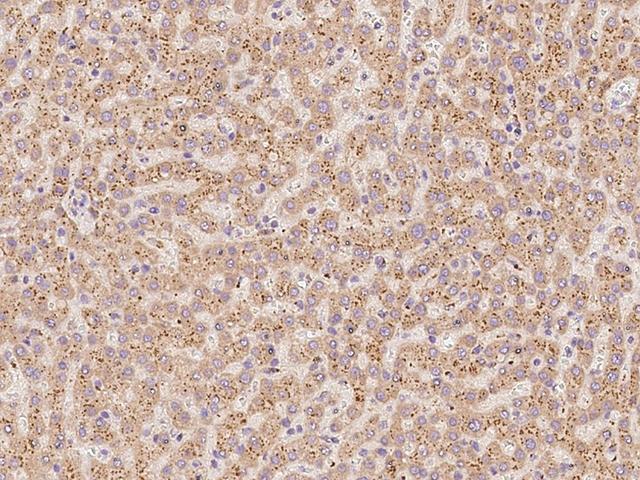 NDUFA2 Antibody - Immunochemical staining of human NDUFA2 in human liver with rabbit polyclonal antibody at 1:100 dilution, formalin-fixed paraffin embedded sections.