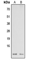 NDUFA3 / B9 Antibody - Western blot analysis of NDUFA3 expression in HEK293T (A); Raw264.7 (B) whole cell lysates.