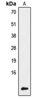 NDUFA4 Antibody - Western blot analysis of NDUFA4 expression in HeLa (A) whole cell lysates.