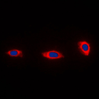 NDUFA4 Antibody - Immunofluorescent analysis of NDUFA4 staining in HeLa cells. Formalin-fixed cells were permeabilized with 0.1% Triton X-100 in TBS for 5-10 minutes and blocked with 3% BSA-PBS for 30 minutes at room temperature. Cells were probed with the primary antibody in 3% BSA-PBS and incubated overnight at 4 C in a humidified chamber. Cells were washed with PBST and incubated with a DyLight 594-conjugated secondary antibody (red) in PBS at room temperature in the dark. DAPI was used to stain the cell nuclei (blue).