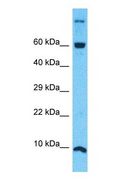 NDUFA4 Antibody - Western blot of NDUFA4 Antibody with human 721_B Whole Cell lysate.  This image was taken for the unconjugated form of this product. Other forms have not been tested.