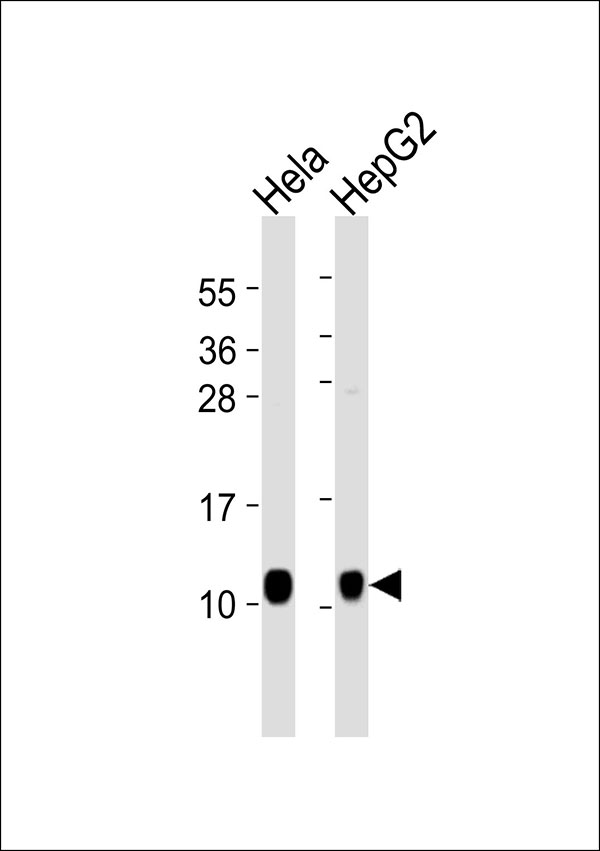 NDUFA4 Antibody - All lanes : Anti-NDUFA4 Antibody at 1:1000 dilution Lane 1: HeLa whole cell lysates Lane 2: HepG2 whole cell lysates Lysates/proteins at 20 ug per lane. Secondary Goat Anti-Rabbit IgG, (H+L),Peroxidase conjugated at 1/10000 dilution Predicted band size : 9 kDa Blocking/Dilution buffer: 5% NFDM/TBST.