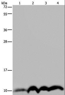 NDUFA4 Antibody - Western blot analysis of SKOV3 cell and human fetal liver tissue, human fetal brain tissue and HeLa cell, using NDUFA4 Polyclonal Antibody at dilution of 1:300.