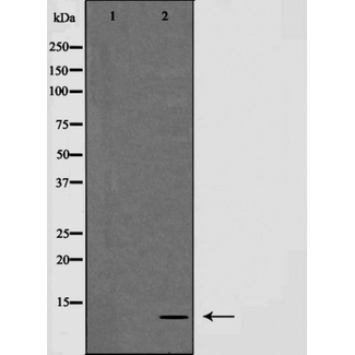 NDUFA4 Antibody - Western blot analysis of NDUFA4 expression in HepG2 cells. The lane on the left is treated with the antigen-specific peptide.