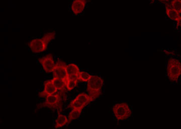 NDUFA4 Antibody - Staining HepG2 cells by IF/ICC. The samples were fixed with PFA and permeabilized in 0.1% Triton X-100, then blocked in 10% serum for 45 min at 25°C. The primary antibody was diluted at 1:200 and incubated with the sample for 1 hour at 37°C. An Alexa Fluor 594 conjugated goat anti-rabbit IgG (H+L) Ab, diluted at 1/600, was used as the secondary antibody.
