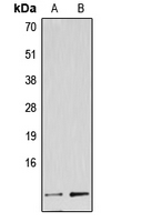 NDUFA4L2 Antibody - Western blot analysis of NDUFA4L2 expression in HUVEC (A); HeLa (B) whole cell lysates.