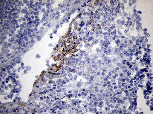 NDUFA4L2 Antibody - Immunohistochemical staining of paraffin-embedded Human tonsil within the normal limits using anti-NDUFA4L2 mouse monoclonal antibody. (Heat-induced epitope retrieval by 1mM EDTA in 10mM Tris buffer. (pH8.5) at 120°C for 3 min. (1:500)