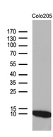 NDUFA4L2 Antibody - Western blot analysis of extracts. (35ug) from COLO205 cell line by using anti-NDUFA4L2 monoclonal antibody. (1:500)