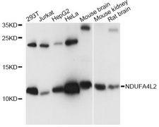 NDUFA4L2 Antibody - Western blot analysis of extracts of various cell lines, using NDUFA4L2 antibody at 1:1000 dilution. The secondary antibody used was an HRP Goat Anti-Rabbit IgG (H+L) at 1:10000 dilution. Lysates were loaded 25ug per lane and 3% nonfat dry milk in TBST was used for blocking. An ECL Kit was used for detection and the exposure time was 5s.