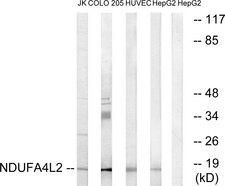 NDUFA4L2 Antibody - Western blot analysis of extracts from Jurkat cells, COLO cells, HUVEC cells and HepG2 cells, using NDUFA4L2 antibody.