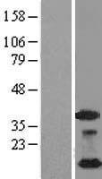 NDUFA4L2 Protein - Western validation with an anti-DDK antibody * L: Control HEK293 lysate R: Over-expression lysate
