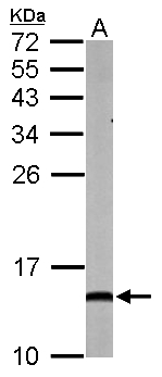 NDUFA5 Antibody - Sample (50 ug of whole cell lysate). A: mouse brain. 15% SDS PAGE. NDUFA5 antibody diluted at 1:1000.