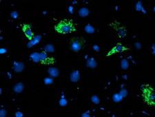 NDUFA5 Antibody - Anti-NDUFA5 mouse monoclonal antibody immunofluorescent staining of COS7 cells transiently transfected by pCMV6-ENTRY NDUFA5.
