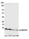 NDUFA5 Antibody - Detection of human and mouse NDUFA5 by western blot. Samples: Whole cell lysate (50 µg) from HeLa, HEK293T, Jurkat, and mouse TCMK-1, cells prepared using NETN lysis buffer. Antibody: Affinity purified rabbit anti-NDUFA5 antibody used for WB at 0.1 µg/ml. Detection: Chemiluminescence with an exposure time of 30 seconds.