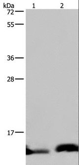NDUFA5 Antibody - Western blot analysis of Human hepatocellular carcinoma and fetal brain tissue, using NDUFA5 Polyclonal Antibody at dilution of 1:400.