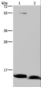 NDUFA5 Antibody - Western blot analysis of Human bladder carcinoma and fetal brain tissue, using NDUFA5 Polyclonal Antibody at dilution of 1:400.