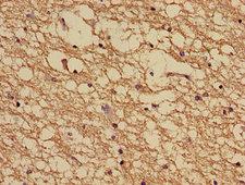 NDUFA5 Antibody - Immunohistochemistry image of paraffin-embedded human brain tissue at a dilution of 1:100