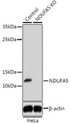 NDUFA5 Antibody - Western blot analysis of extracts from normal (control) and NDUFA5 knockout (KO) HeLa cells, using NDUFA5 antibody at 1:1000 dilution. The secondary antibody used was an HRP Goat Anti-Rabbit IgG (H+L) at 1:10000 dilution. Lysates were loaded 25ug per lane and 3% nonfat dry milk in TBST was used for blocking. An ECL Kit was used for detection and the exposure time was 15s.