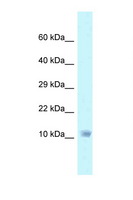 NDUFA6 Antibody - NDUFA6 antibody Western blot of HeLa Cell lysate. Antibody concentration 1 ug/ml.  This image was taken for the unconjugated form of this product. Other forms have not been tested.