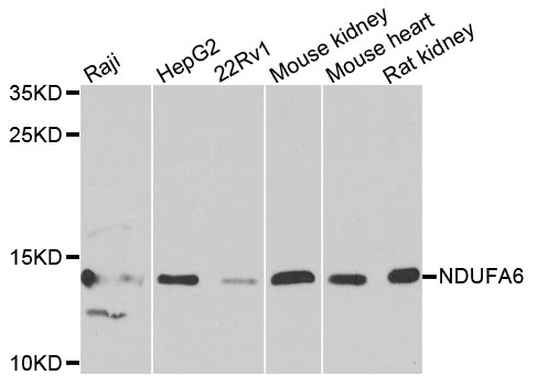 NDUFA6 Antibody - Western blot analysis of extracts of various cells.