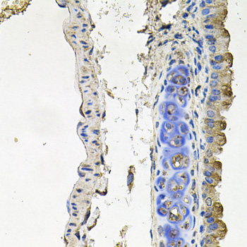 NDUFA6 Antibody - Immunohistochemistry of paraffin-embedded mouse lung tissue.