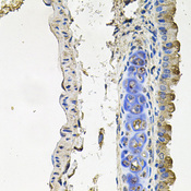 NDUFA6 Antibody - Immunohistochemistry of paraffin-embedded mouse lung tissue.