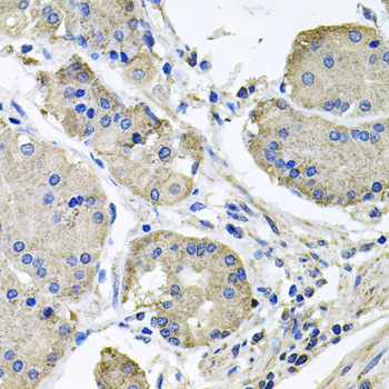 NDUFA6 Antibody - Immunohistochemistry of paraffin-embedded human stomach tissue.