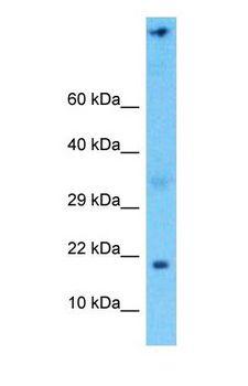 NDUFA6 Antibody - Western blot of NDUFA6 Antibody with human 293T Whole Cell lysate.  This image was taken for the unconjugated form of this product. Other forms have not been tested.